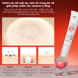 Kem nám LoanMedi Melasma Care Cream