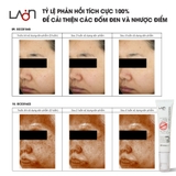 Kem nám LoanMedi Melasma Care Cream