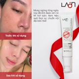 Kem nám LoanMedi Melasma Care Cream