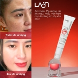 Kem nám LoanMedi Melasma Care Cream