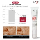 Kem nám LoanMedi Melasma Care Cream