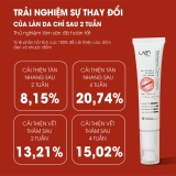 Kem nám LoanMedi Melasma Care Cream