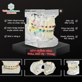 Hàm tư vấn chỉnh nha full khí cụ - Trong