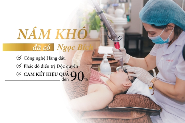 3 LÍ DO NÊN ĐIỀU TRỊ NÁM TẠI NGỌC BÍCH