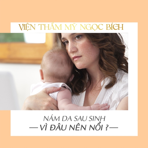 MẸ BỈM SỮA CẦN BIẾT NÁM DA SAU SINH - NGUYÊN NHÂN VÌ SAO❓