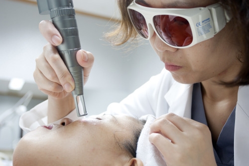 Laser Toning – giải pháp đặc trị mọi loại nám
