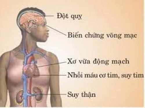 Nguyên nhân và các biến chứng của cao huyết áp?