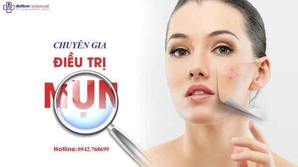 BỎ TÚI MỘT SỐ SẢN PHẨM TRỊ MỤN HIỆU QUẢ DỄ DÀNG TÌM THẤY TẠI  NHÀ THUỐC