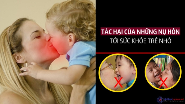 Những nguy hại tiềm ẩn ảnh hưởng đến sức khỏe của trẻ từ những nụ hôn