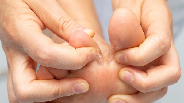 4  Bệnh Da Liễu Bùng Phát Sau Bão Lũ