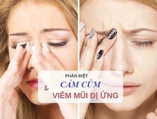 PHÂN BIỆT VIÊM MŨI DỊ ỨNG VÀ CẢM CÚM