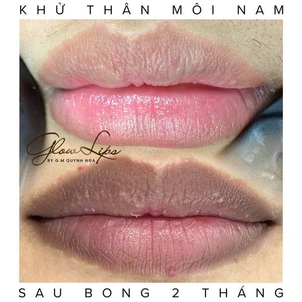 khu-tham-moi-nam