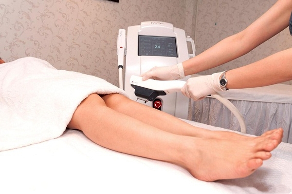 cong-nghe-triet-long-diode-laser