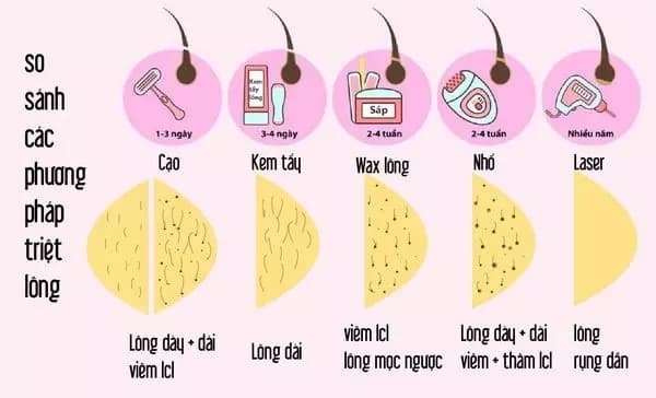 so-sanh-cac-phuong-phap-triet-long