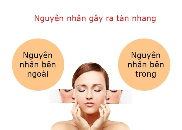 nguyen-nhan-gay-ra-tan-nhang