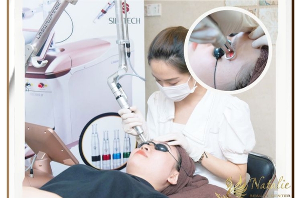 xoa-xam-long-may-bang-laser