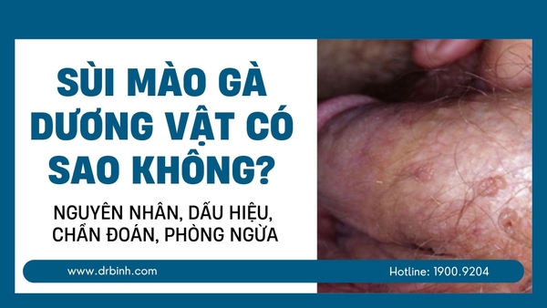 Sùi mào gà dương vật có sao không? Nguyên nhân, dấu hiệu, chẩn đoán, phòng ngừa