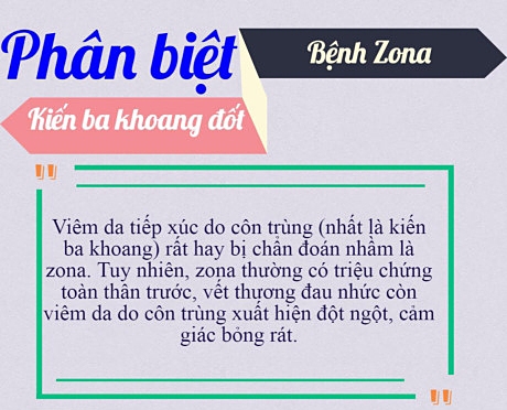 phan-biet-kien-ba-khoang-dot-va-benh-zona