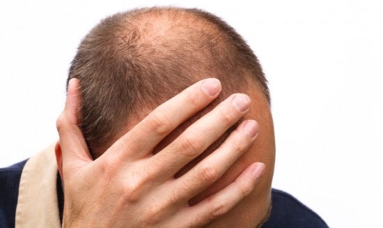 Nguyên nhân thực sự của bệnh rụng tóc nhiều người đang mắc phải  Y Dược  Học Việt Nam