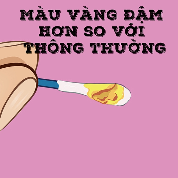 Ray-tai-vang-dam-hon-binh-thuong-suc-khoe-drbinh-1