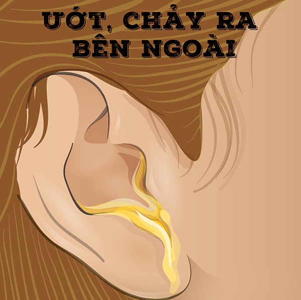 ray-tai-chay-ra-khoi-ngoai-tai-suc-khoe-drbinh