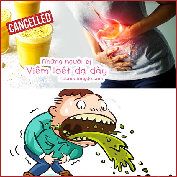 TOP 7+ những người không nên uống tinh bột nghệ CỰC CHUẨN