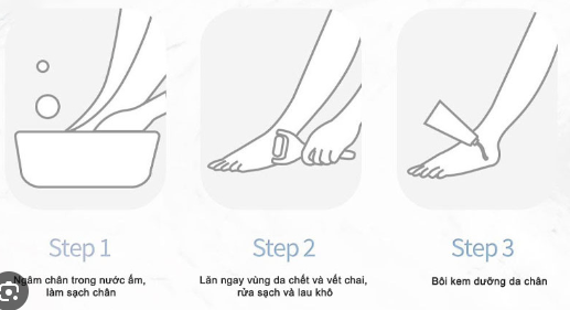 Máy mài gót chân ShowSee