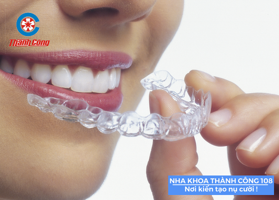 Niềng răng Invisalign