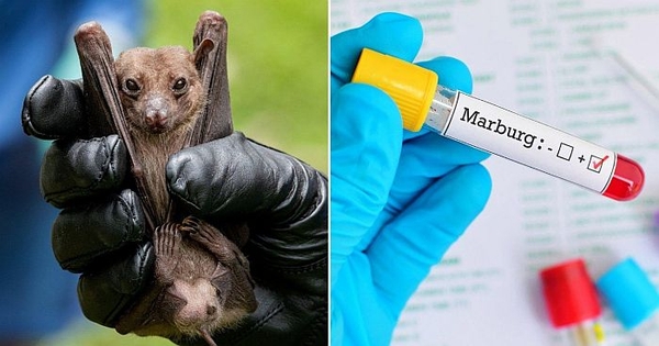 Virus Marburg nguy hiểm đến mức độ nào?