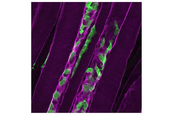 Thiếu protein laminin-α2 cản trở quá trình tái tạo cơ trong bệnh loạn dưỡng cơ hiếm gặp