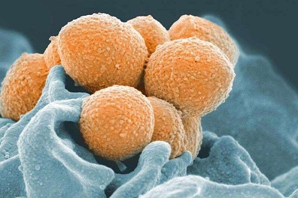 Mô hình nghiên cứu vi khuẩn Strep A trên người mới mở đường cho các thử nghiệm vắc xin chống lại vi khuẩn chết người