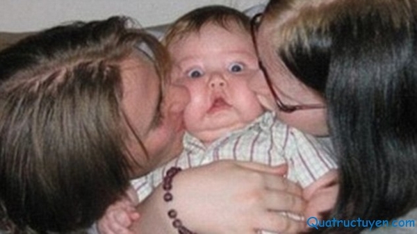 Mách mẹ vài bí quyết giúp bé sơ sinh không bị bẹt đầu