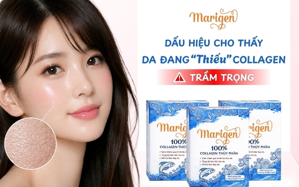 3 DẤU HIỆU “ÂM THẦM” CẢNH BÁO LÀN DA BẠN ĐANG THIẾU COLLAGEN NGHIÊM TRỌNG