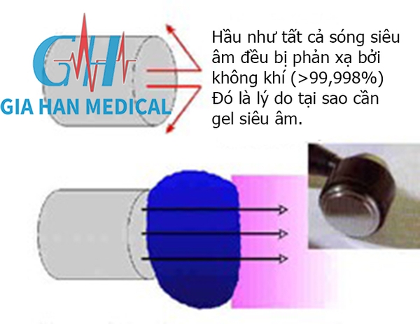 Siêu Âm Trị Liệu Là Gì ? Cơ sở <br>Vật lý và Đặc điểm