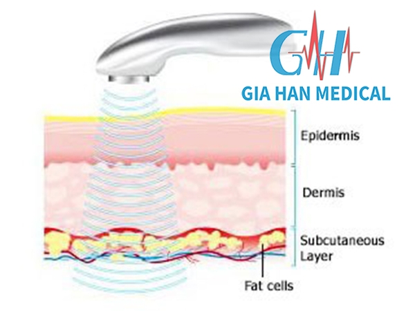 Siêu âm trị liệu và quá trình <br>chữa lành Mô