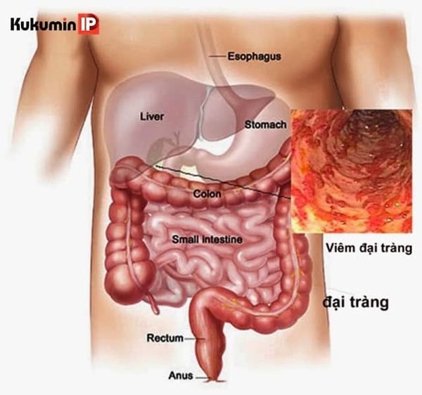 dau-viem-dai-trang