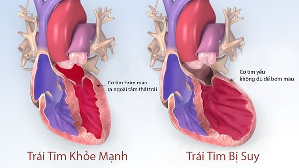 dong-y-dieu-tri-benh-loan-nhip-tim