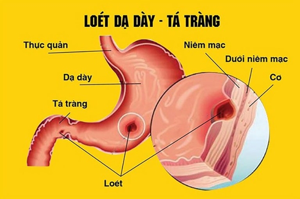 loet-da-day