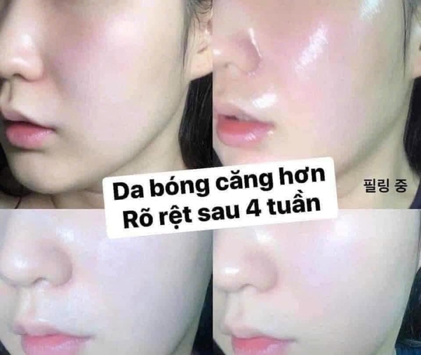 Gel Tẩy Tế Bào Chết PHA Thế Hệ Mới CNP Laboratory Invisible Peeling Booster Essence 100ml