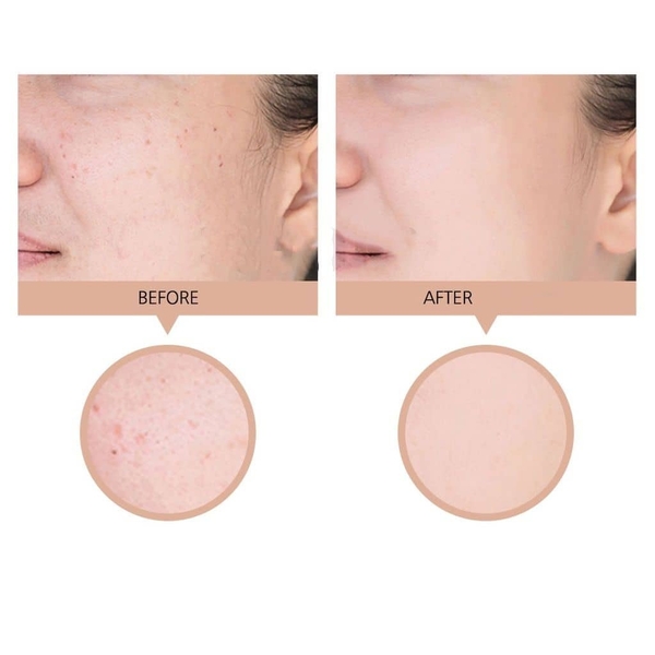 Kem nền mỏng mịn, lâu trôi PrettySkin Collagen Foundation Long Lasting Perfect Cover 100ml