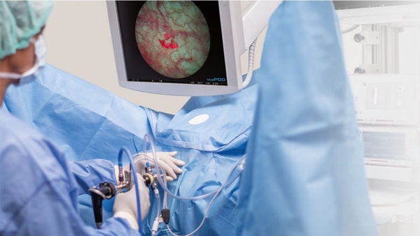 Hệ thống phẫu thuật nội soi PDD System Blue - Richard Wolf