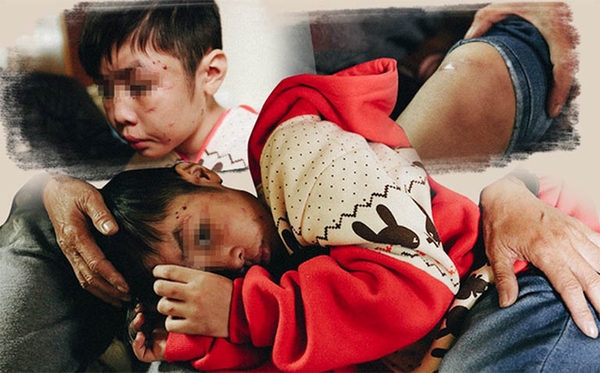 Nhận biết trẻ bị bạo hành khi đi nhà trẻ