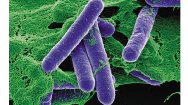 Cách phòng tránh ngộ độc thực phẩm do độc tố botulinum