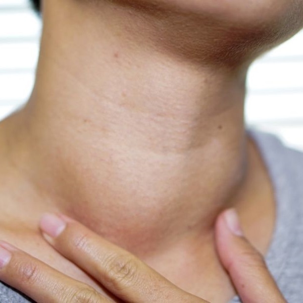 Các thực phẩm ngừa bệnh bướu cổ hiệu quả & tốt nhất hiện nay