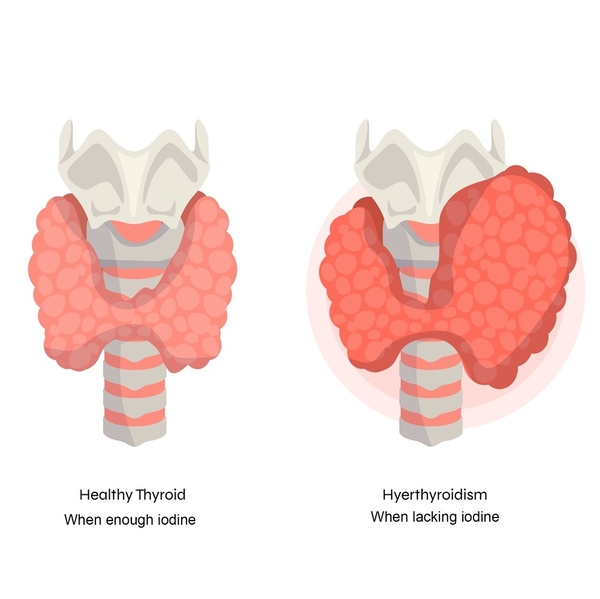 Discover the nutrients in sea moss for gut health
