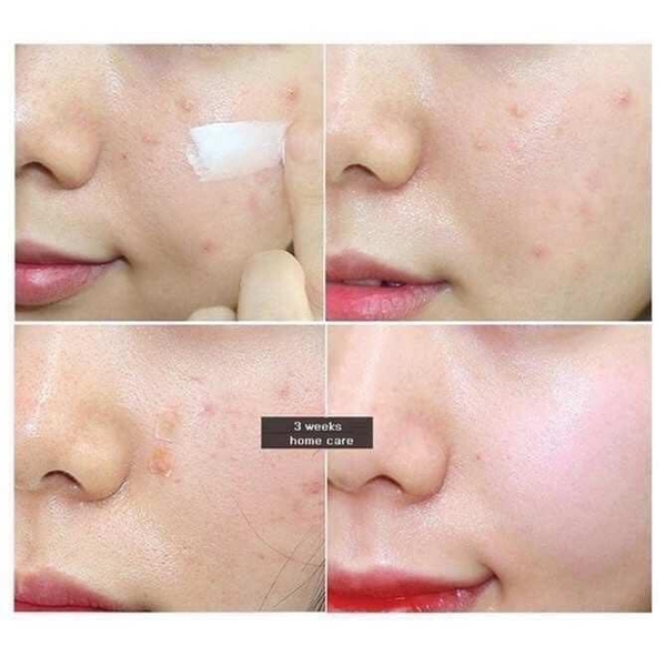 Kem dưỡng rau má phục hồi da Skin1004 Centella Madagascar Centella Cream/ Soothing Cream