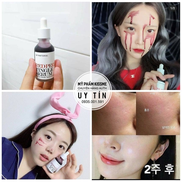 Tinh Chất Tẩy Da Chết Hóa Học So' Natural Red Peel Tingle Serum