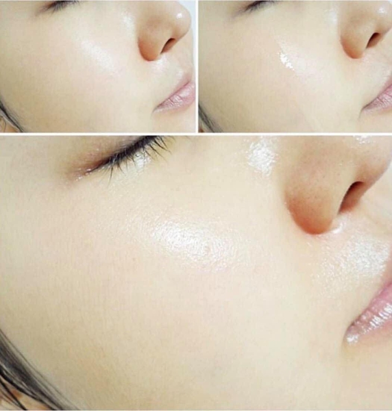 Tinh chất trắng da Medi peel Glutathione White Ampoule Serum 30ml