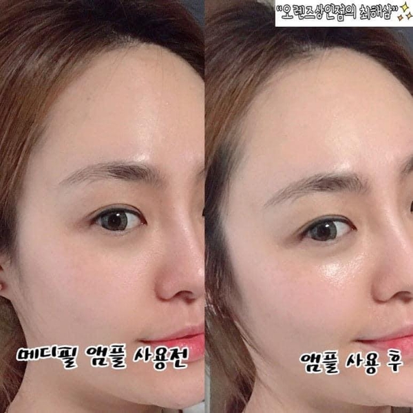 Tinh chất trắng da Medi peel Glutathione White Ampoule Serum 30ml