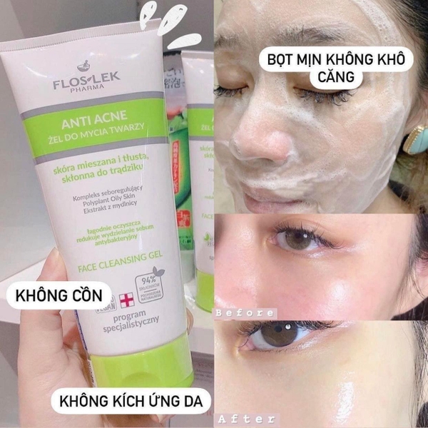 Sữa Rửa Mặt Floslek Anti Acne Bacterial Face Cleansing Gel